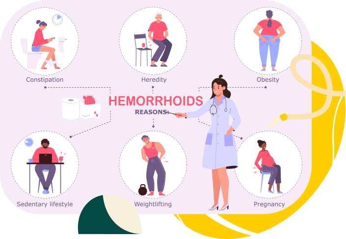 Understanding Haemorrhoids