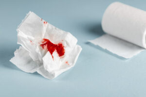 Blood on toilet paper, a common first sign of haemorrhoids